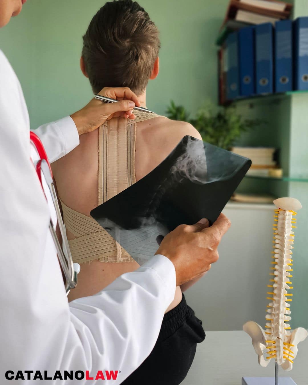 Getting Compensation for Disfigurement After an Accident