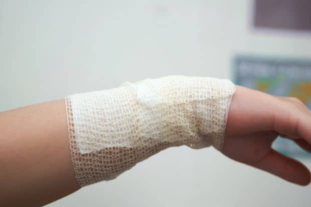 Syracuse Burn Injury Lawyer